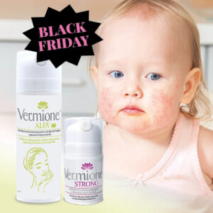 BALÍČEK PÉČE PRO PLEŤ SE SKLONY K PERIORÁLNÍ DERMATITIDĚ – ALFA XL