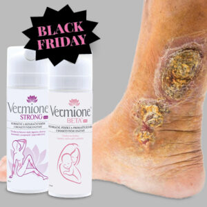 BALÍČEK OBNOVUJÍCÍ PÉČE O POKOŽKU V OBLASTI BÉRCE XXL